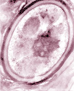 bacteria1.jpg